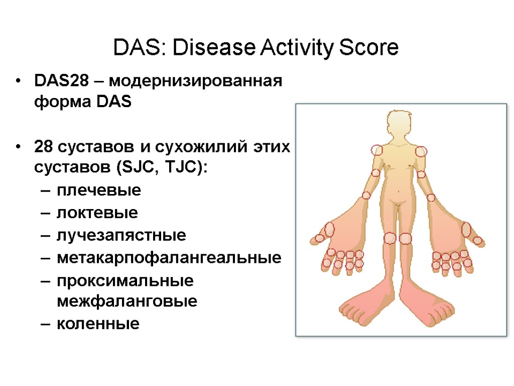 DAS28 – модернизированная форма DAS 28 суставов и сухожилий этих суставов (SJC, TJC): плечевые